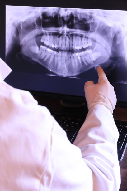 Best Emergency Root Canal Therapy in Grosse Pointe Park, MI