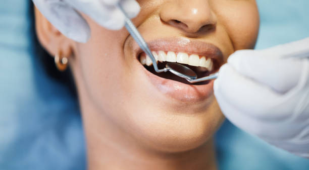 Best Lost Filling or Crown Replacement in Grosse Pointe Park, MI