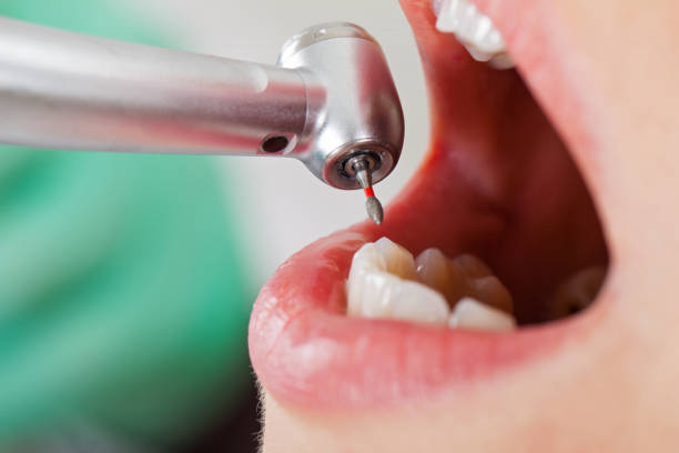 Best Dental Abscess Treatment in Grosse Pointe Park, MI